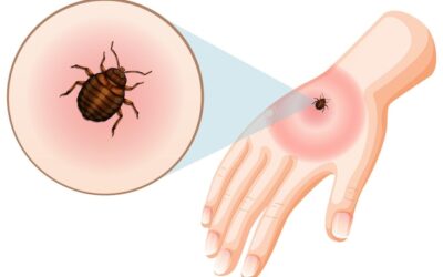 Blog 9 How to Identify Spider Bites vs Bed Bug Bites – What Are the Differences?